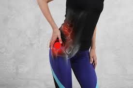 9 Secrets to Get Rid of Hip Bursitis Quickly and Naturally