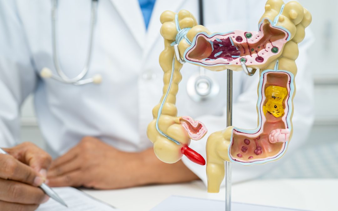 The Surprising Link Between Your Gut Microbiome and Cholesterol Level