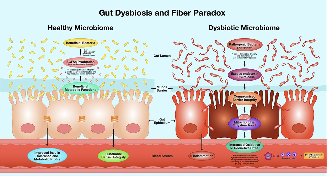 gut-dysbiosis-fiber-paradox