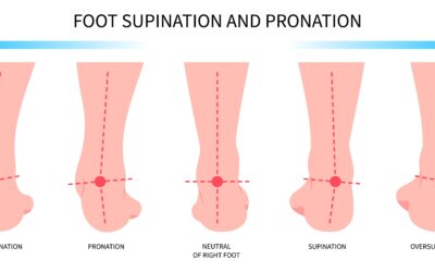 Foot Pronation Part 3: Same Foundation, Different Symptoms
